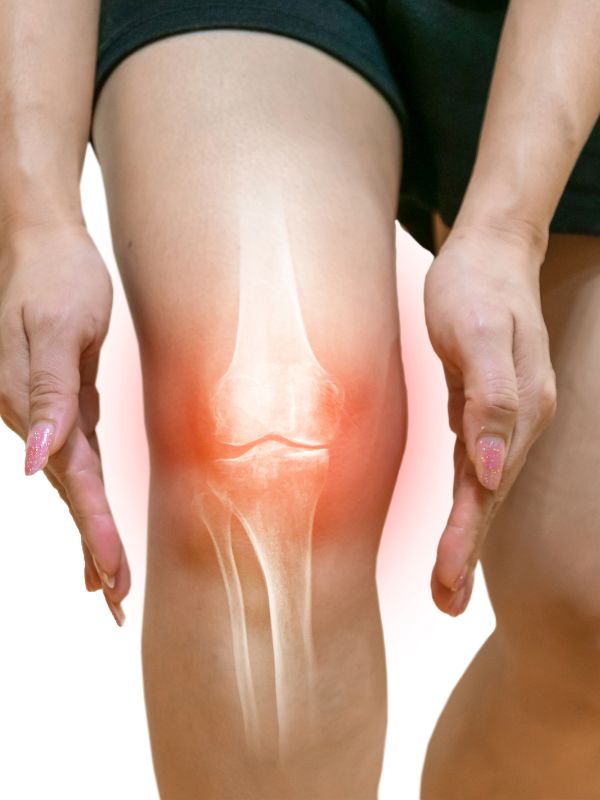 Knestøtte artrose