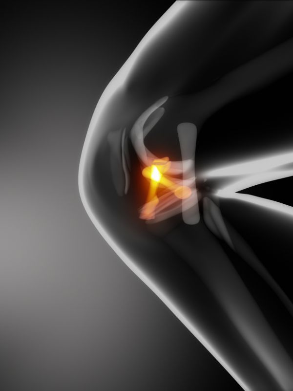 Knestøtte korsbånd